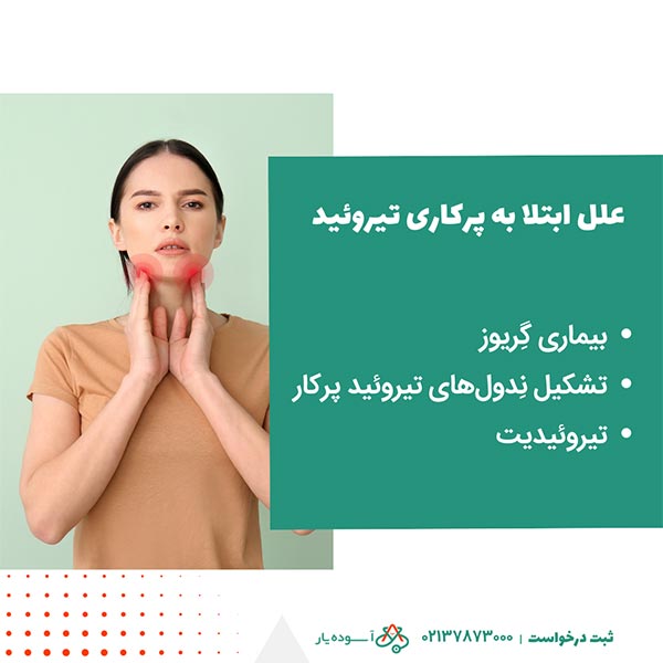 علل ابتلا به پرکاری تیروئید