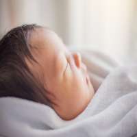 درمان زردی نوزاد در خانه