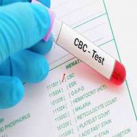 آزمایش هماتوکریت خون چیست؟
